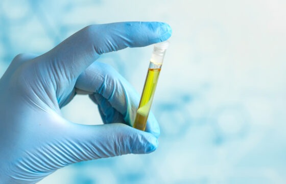 Poloprovozní zkoušky | HUTIRA voda